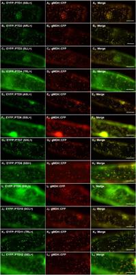 Identification of Arabidopsis Protein Kinases That Harbor Functional Type 1 Peroxisomal Targeting Signals